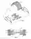 Fig. 03 - DISPOSABLE ACETABULAR REAMER AND METHOD OF FABRICATING THE SAME