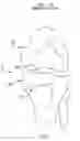 Fig. 02 - Method and apparatus for performing an open wedge, high tibial osteotomy