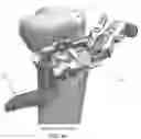 Fig. 40 - Method and apparatus for performing an open wedge, high tibial osteotomy