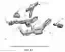 Fig. 43 - Method and apparatus for performing an open wedge, high tibial osteotomy