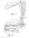 Fig. 02 - Systems and methods for compressing and distracting vertebrae of the spinal column