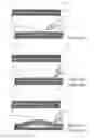 Fig. 03 - HOOD METHOD AND DEVICE FOR ENDOSCOPIC SUBMUCOSAL DISSECTION
