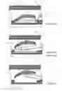 Fig. 05 - HOOD METHOD AND DEVICE FOR ENDOSCOPIC SUBMUCOSAL DISSECTION