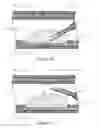 Fig. 07 - HOOD METHOD AND DEVICE FOR ENDOSCOPIC SUBMUCOSAL DISSECTION