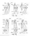 Fig. 03 - Circumcision Clamp