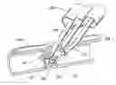 Fig. 01 - THREE-NEEDLE CLOSURE DEVICE