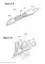 Fig. 05 - THREE-NEEDLE CLOSURE DEVICE