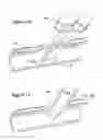 Fig. 11 - THREE-NEEDLE CLOSURE DEVICE