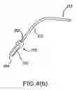 Fig. 06 - Insertion device for delivery of a mesh carrier