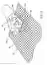 Fig. 22 - Insertion device for delivery of a mesh carrier