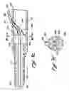 Fig. 06 - Embolectomy Catheters And Methods For Treating Stroke And Other Small Vessel Thromboembolic Disorders