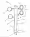 Fig. 01 - Percutaneous Gastroplasty