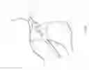 Fig. 33 - Percutaneous Gastroplasty