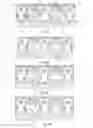 Fig. 07 - IMPLANTABLE SUPPORT DEVICE AND METHOD OF USE