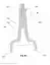Fig. 32 - IMPLANTABLE SUPPORT DEVICE AND METHOD OF USE