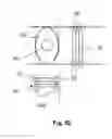 Fig. 45 - IMPLANTABLE SUPPORT DEVICE AND METHOD OF USE