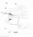 Fig. 52 - IMPLANTABLE SUPPORT DEVICE AND METHOD OF USE