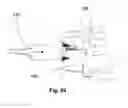 Fig. 53 - IMPLANTABLE SUPPORT DEVICE AND METHOD OF USE