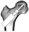 Fig. 01 - Bolt apparatus