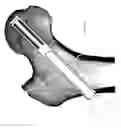 Fig. 08 - Bolt apparatus