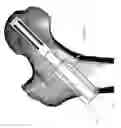 Fig. 09 - Bolt apparatus