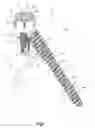 Fig. 02 - Anchor-in-anchor system for use in bone fixation