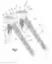 Fig. 09 - Anchor-in-anchor system for use in bone fixation