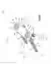Fig. 14 - Anchor-in-anchor system for use in bone fixation