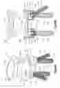 Fig. 41 - Anchor-in-anchor system for use in bone fixation