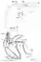 Fig. 02 - Systems and methods for controlling ventricular pacing in patients with long inter-atrial conduction delays