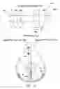 Fig. 09 - Systems and methods for controlling ventricular pacing in patients with long inter-atrial conduction delays