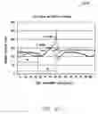 Fig. 22 - Systems and methods for controlling ventricular pacing in patients with long inter-atrial conduction delays