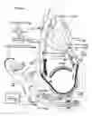 Fig. 02 - Ventricular assist device capable of implantation of stem cells