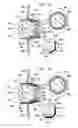 Fig. 02 - ANTI-GLARE SOLUTIONS FOR INTRAOCULAR IMPLANTS