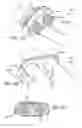 Fig. 22 - Adjustable absorber designs for implantable device