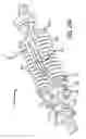 Fig. 47 - Adjustable absorber designs for implantable device