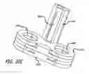 Fig. 52 - Adjustable absorber designs for implantable device