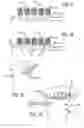 Fig. 07 - JOINT SUPPORT AND SUBCHONDRAL SUPPORT SYSTEM