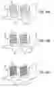 Fig. 10 - JOINT SUPPORT AND SUBCHONDRAL SUPPORT SYSTEM