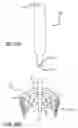 Fig. 23 - JOINT SUPPORT AND SUBCHONDRAL SUPPORT SYSTEM