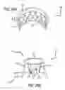 Fig. 27 - JOINT SUPPORT AND SUBCHONDRAL SUPPORT SYSTEM