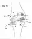 Fig. 29 - JOINT SUPPORT AND SUBCHONDRAL SUPPORT SYSTEM