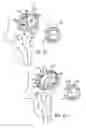 Fig. 09 - PROSTHETIC IMPLANT SUPPORT STRUCTURE