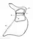 Fig. 01 - Gastric restrictor assembly and method of use