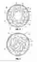 Fig. 06 - Gastric restrictor assembly and method of use