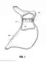 Fig. 07 - Gastric restrictor assembly and method of use