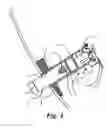 Fig. 04 - Emergency encapsulated lift system