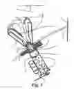 Fig. 05 - Emergency encapsulated lift system