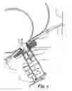Fig. 06 - Emergency encapsulated lift system