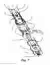 Fig. 07 - Emergency encapsulated lift system
